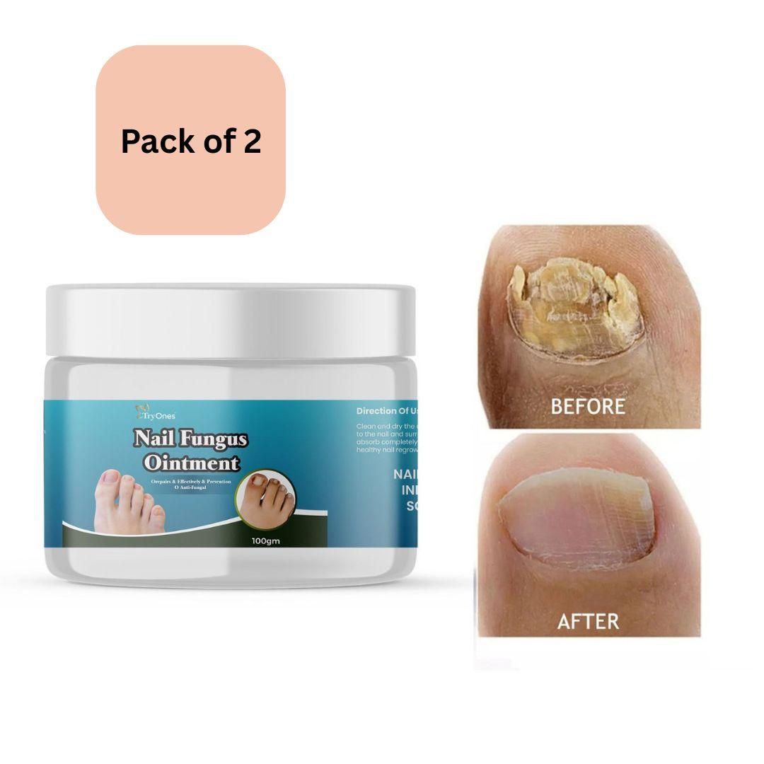 TryOnes Nail Fungus Ointment 100gram (Pack of 2) mkp0fp-jd
