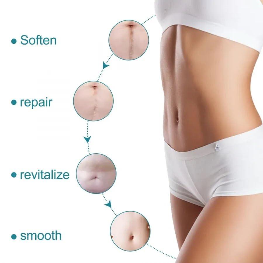 Silicone Scar Sheets, Silicon gel sheets for Scars Transparent Medical Silicone Gel Tape mkp0fp-jd
