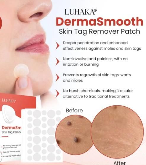 Skin Tag Remover Patch mkp0fp-jd