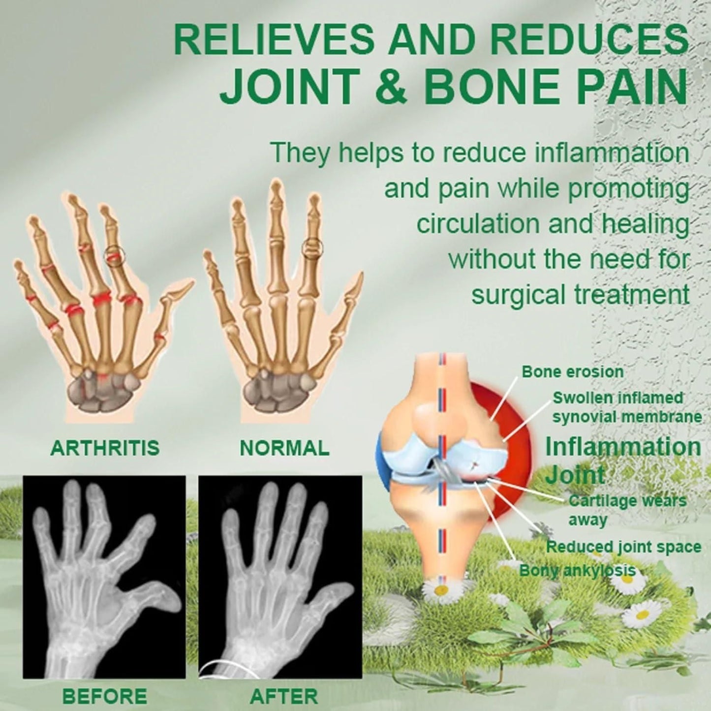 Bee Venom Joint and Bone Therapy Cream 100gm Each (Pack of 2) mkp0fp-jd