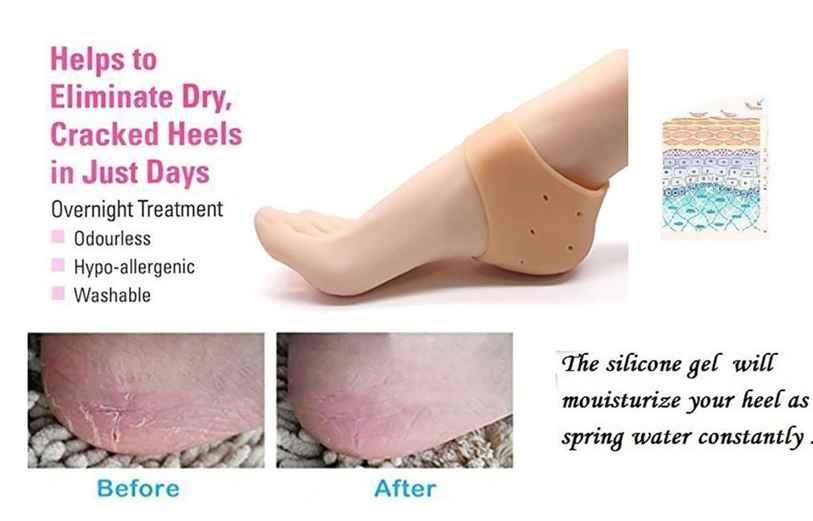 Anti-Crack Silicone Gel Heel Pad mkp0fp-jd