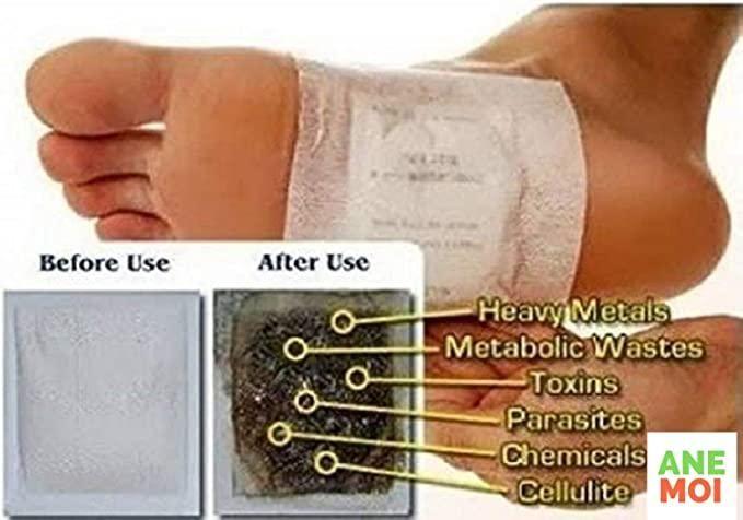 Detox Foot Patches (Set of 10) mkp0fp-jd