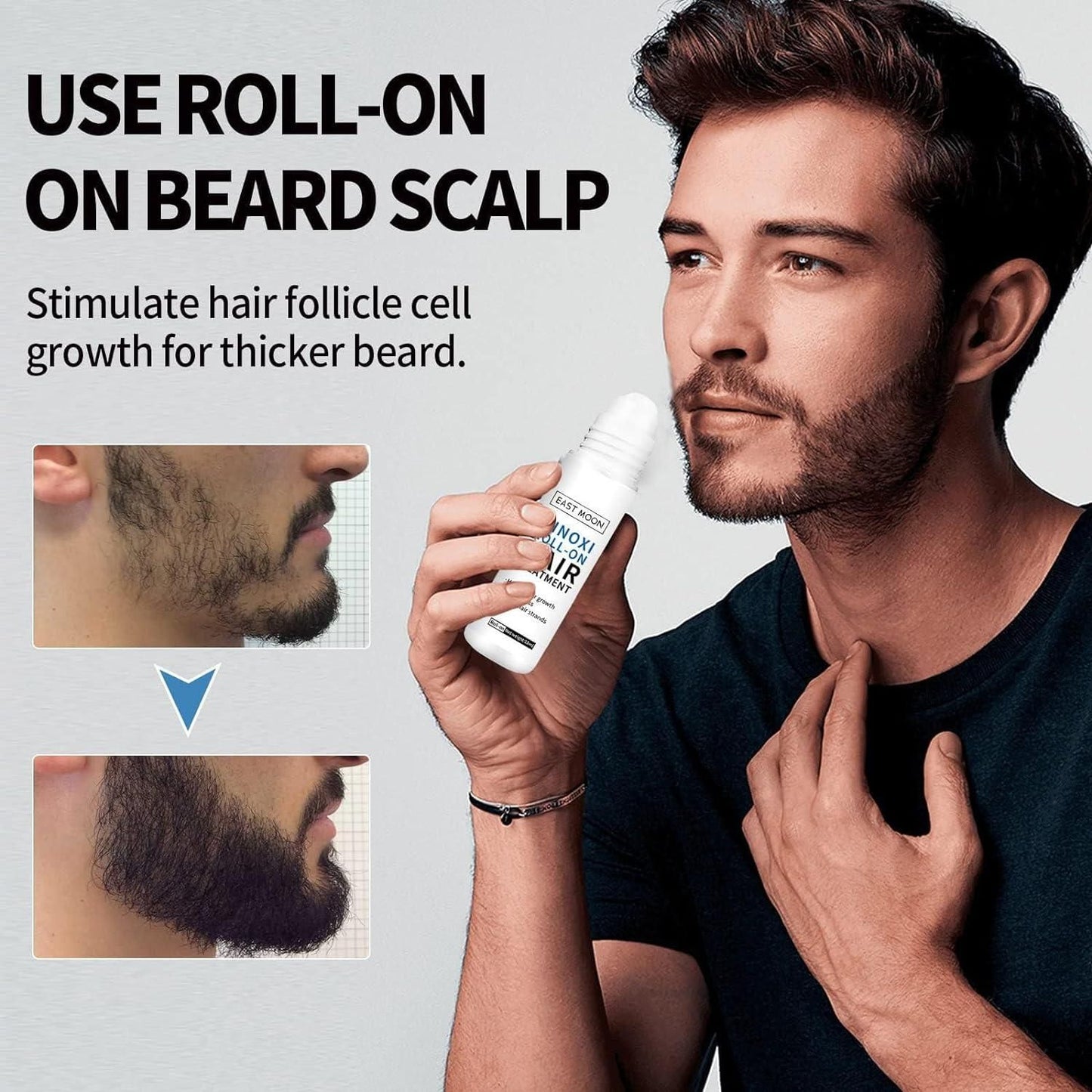 Minoxi Roll-On Hair Treatment Hair Growth Serum For Women & Men (Pack of 2) mkp0fp-jd