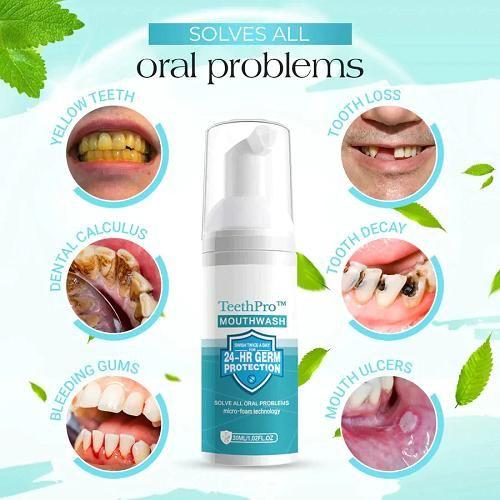 Teeth Whitening Foam 60ML (Pack of 2) mkp0fp-jd