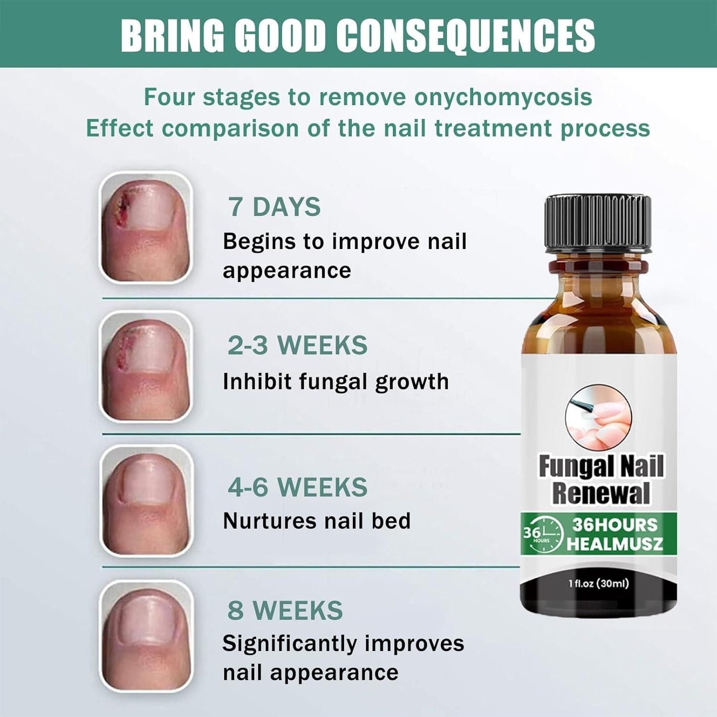 Fungal Nail Renewal 30Ml (Pack of 2) mkp0fp-jd