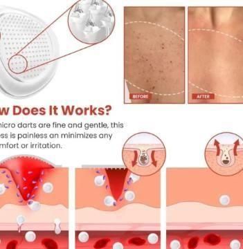 Skin Tag Remover Patch mkp0fp-jd