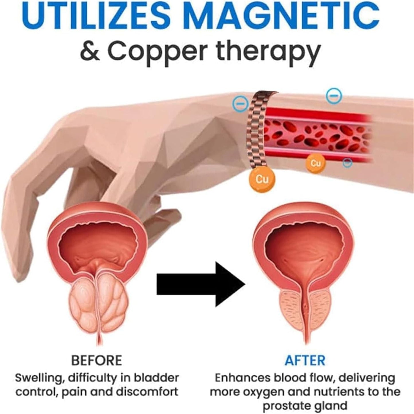 ProstaPower Magnetic Copper Band mkp0fp-jd