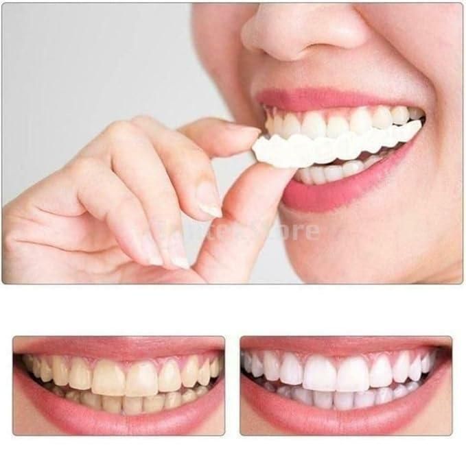 Teeth Brace Temporary Teeth Braces Cover mkp0fp-jd