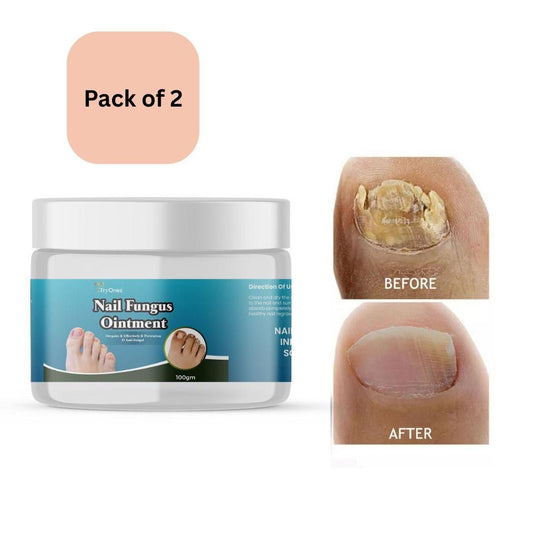 TryOnes Nail Fungus Ointment 100gram (Pack of 2) mkp0fp-jd