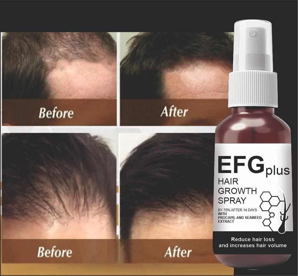EFGPLUS Hair Growth Spray 50ml (Pack of 2) mkp0fp-jd