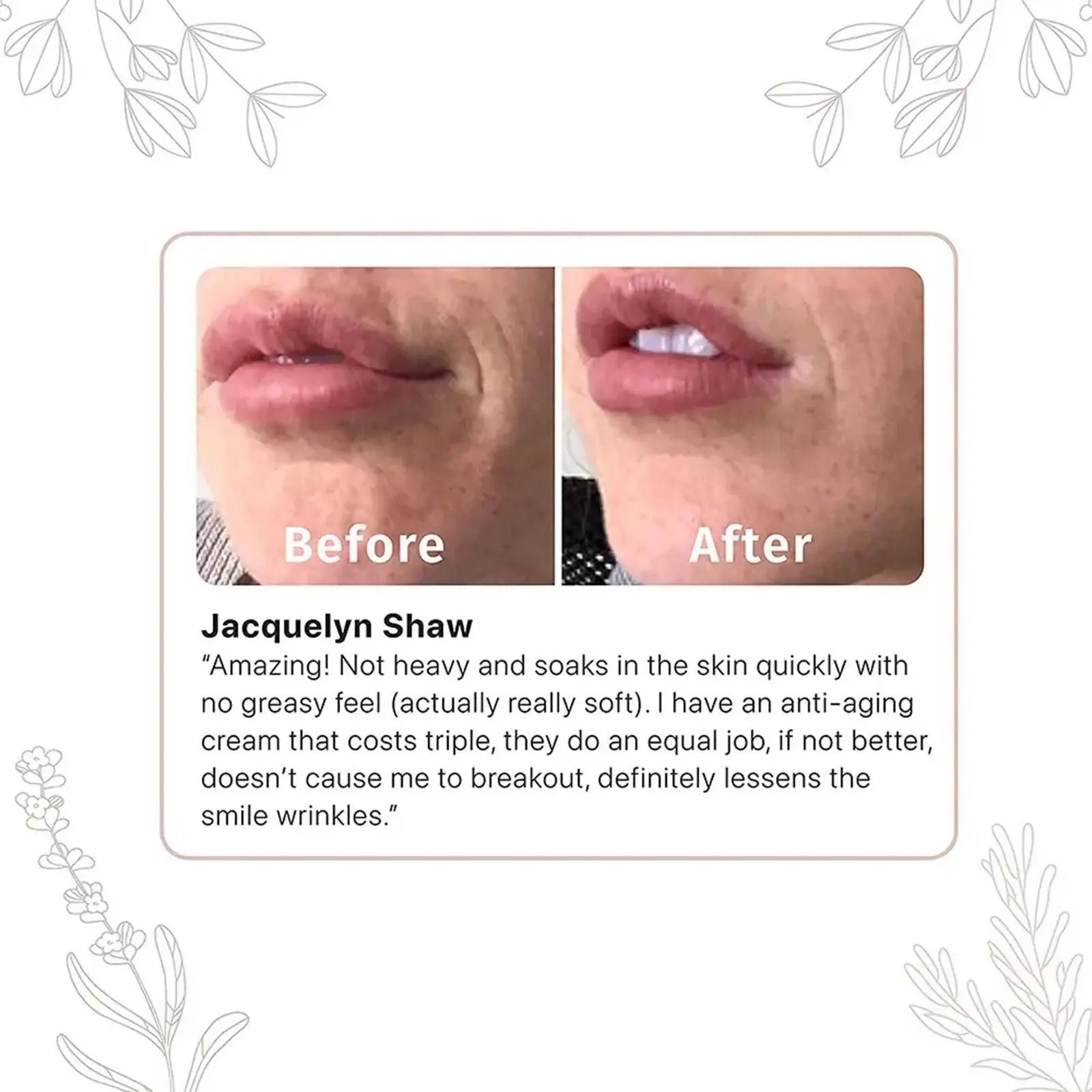 Retinol Cream 50gm Pack of 1 mkp0fp-jd