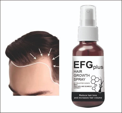 EFGPLUS Hair Growth Spray 50ml (Pack of 2) mkp0fp-jd