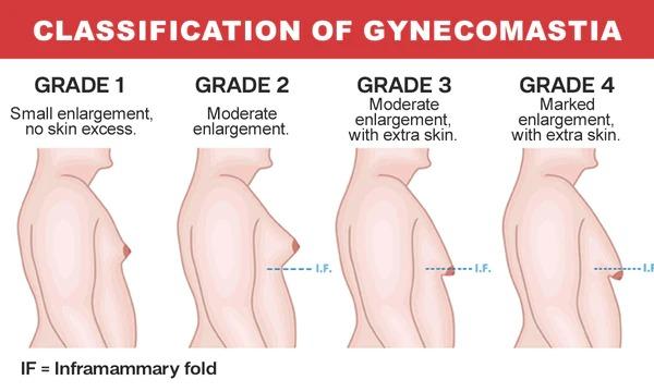 Luhaka Gynecomastia Cream - Chest Fat Burner mkp0fp-jd